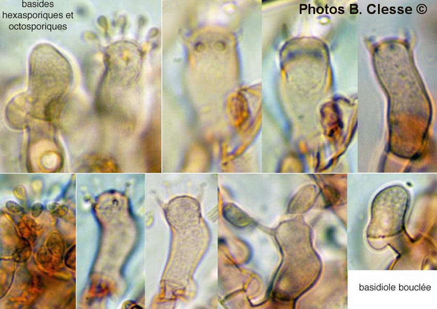 Botryobasidium subcoronatum