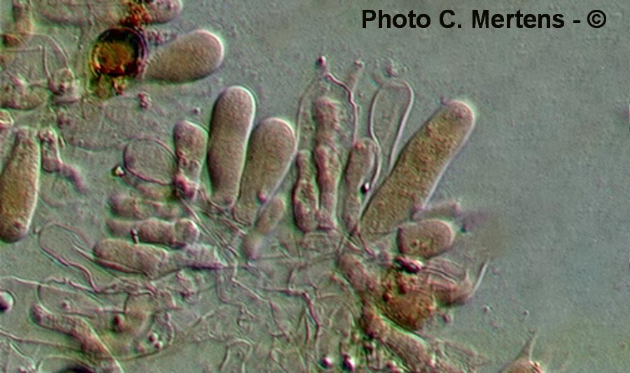 Chromocyphella muscicola