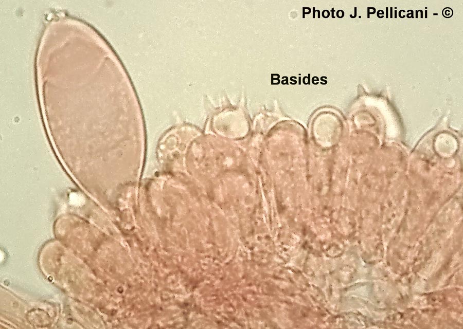 Inocybe curvipes var. globocystis