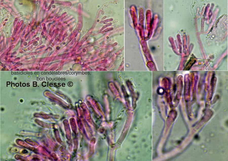 Odonticium septocystidia