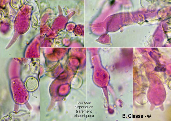 Rhizoctonia fusispora (Thanatephorus fusisporus)