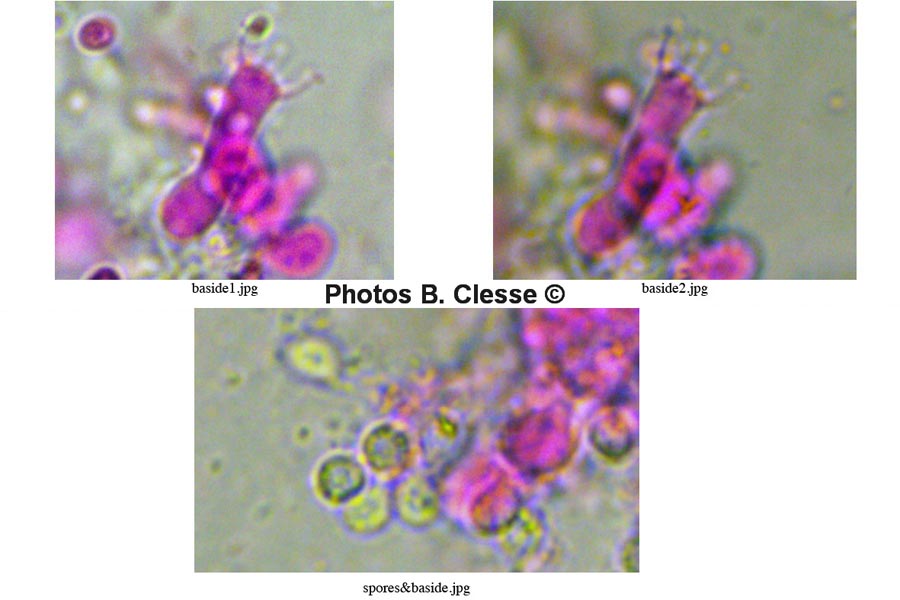 Sistotrema diademiferum