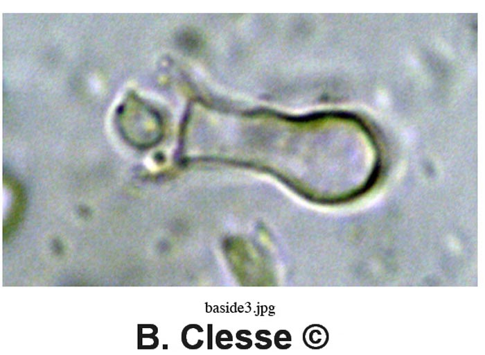 Sistotrema diademiferum