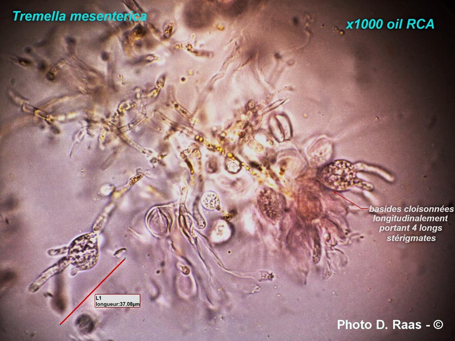 Tremella mesenterica