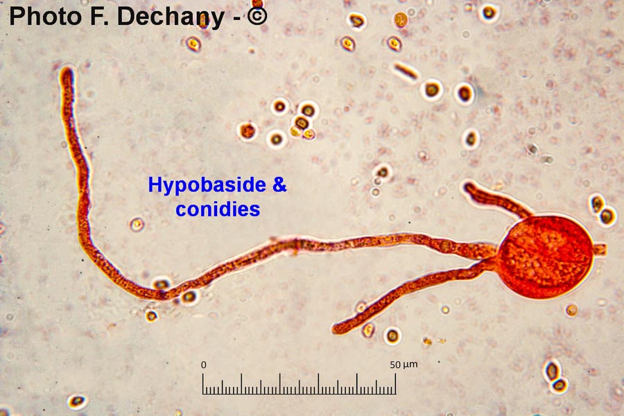 Tremella mesenterica