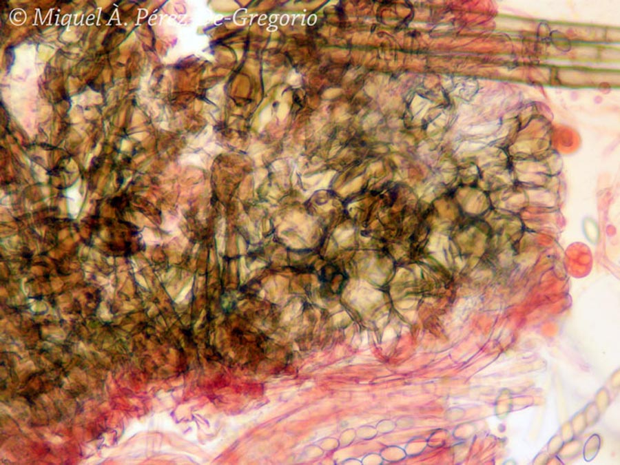 Tricharina striispora