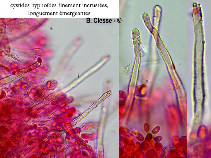 Amphinema byssoides