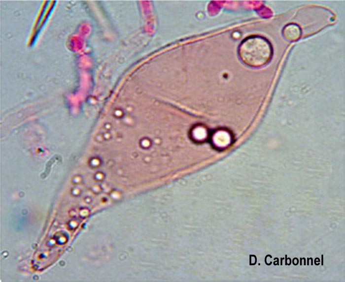 Asterostroma medium