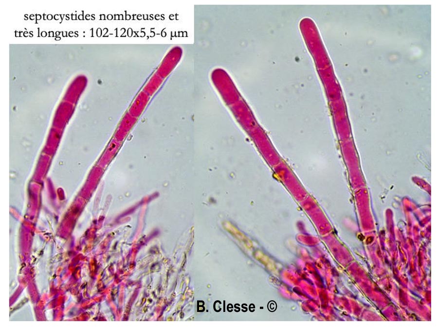 Candelabrochaete septocystidia
