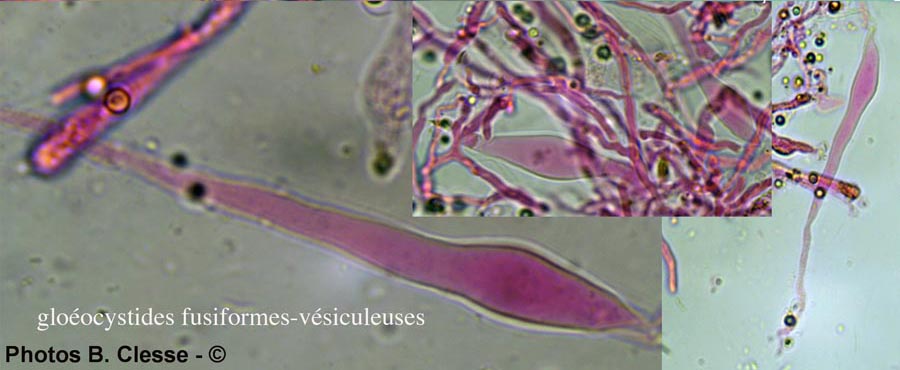 Gloiothele citrina (Vesiculomyces citrinus)