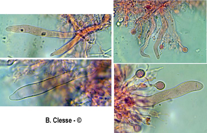 Mycostilla vermiformis (Stypella vermiformis)