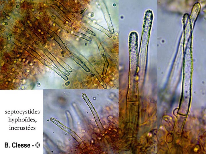 Amphinema byssoides