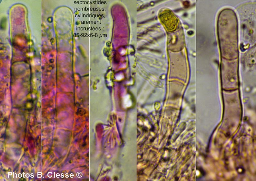 Odonticium septocystidia