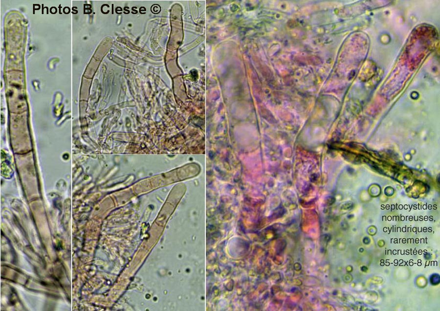 Odonticium septocystidia