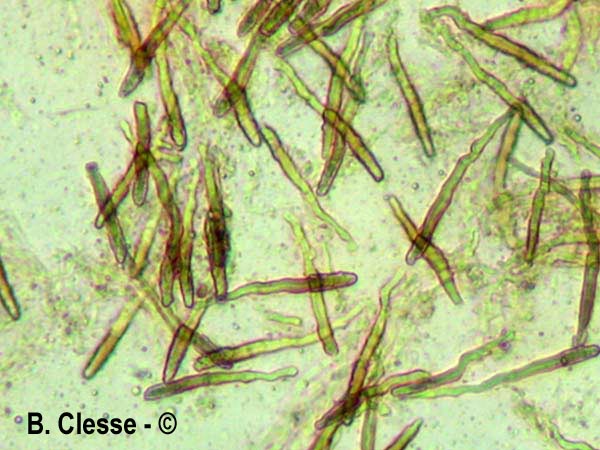 Peniophora piceae