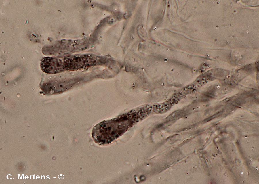 Rugosomyces obscurissimus