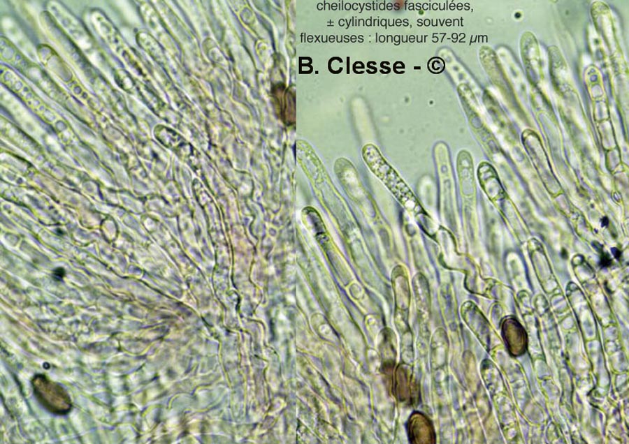 Stropharia squamosa