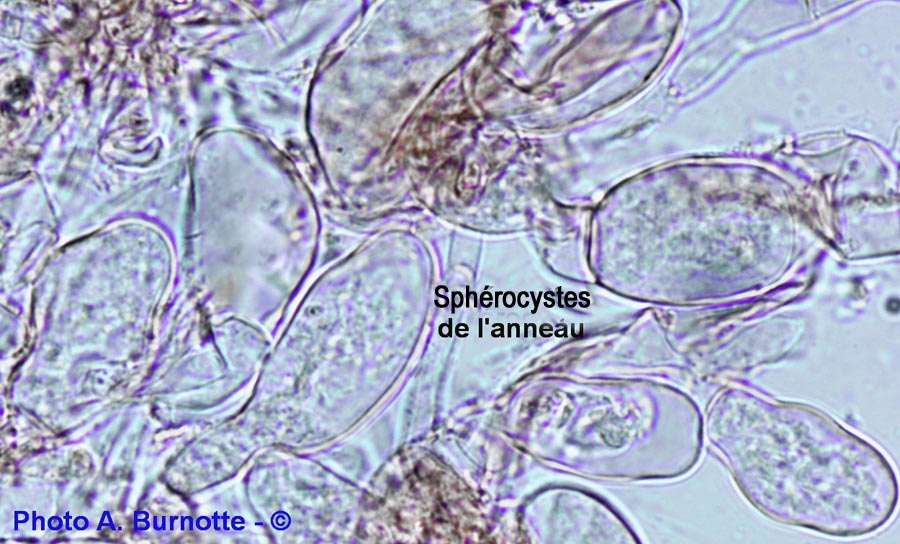 Sphérocyte