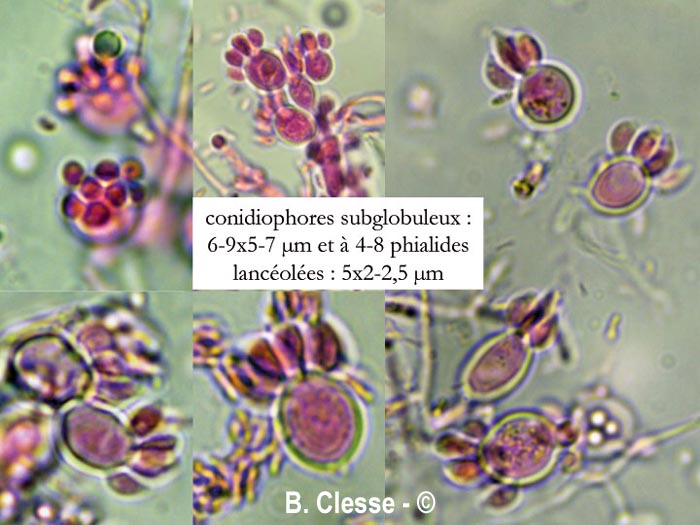 Ascocoryne albida