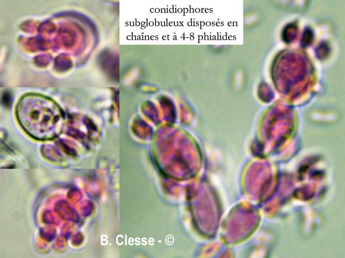 Ascocoryne albida