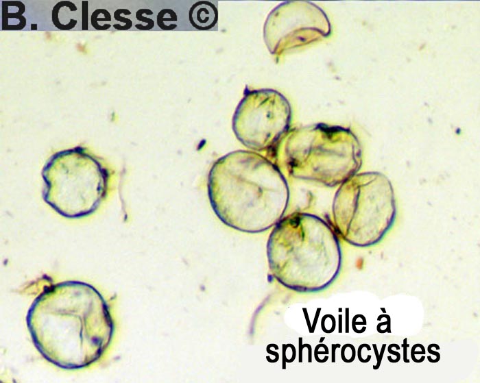 Cystolepiota adulterina