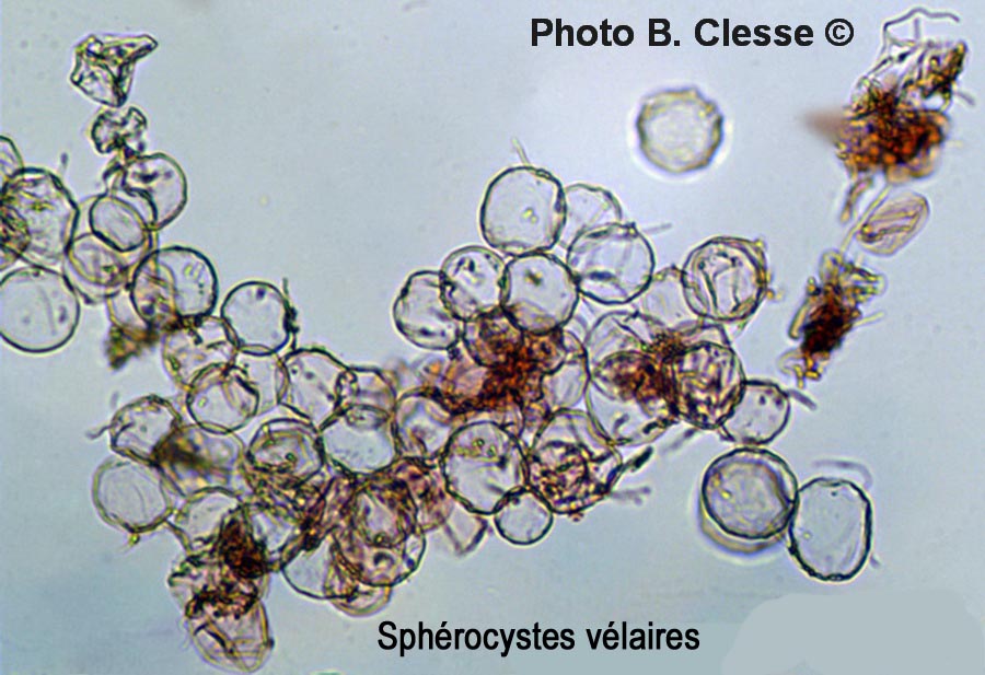 Cystolepiota adulterina