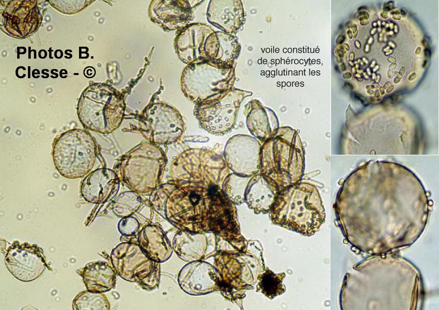 Cystolepiota moelleri