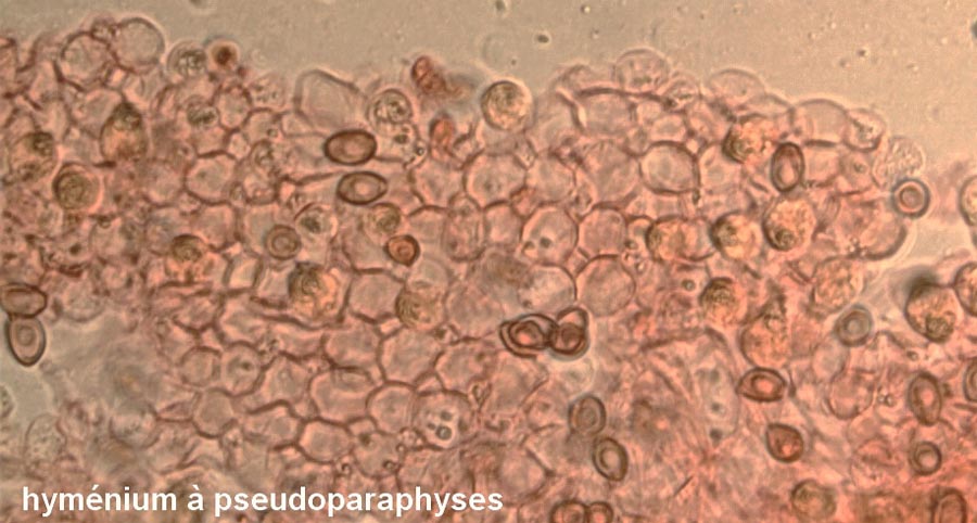 Leucocoprinus cepistipes f. macrosporus