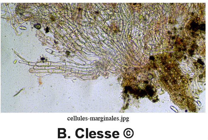 Octospora musci-muralis