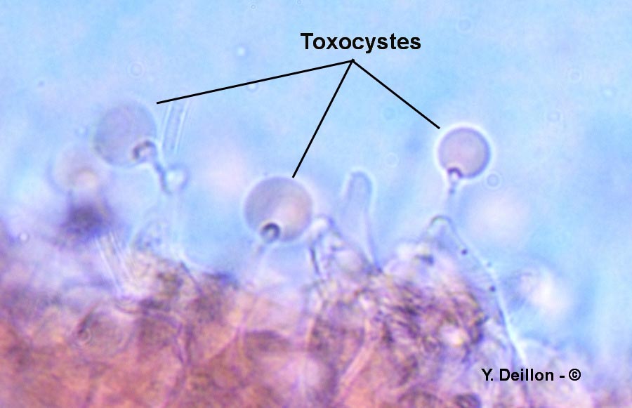 Toxocyste