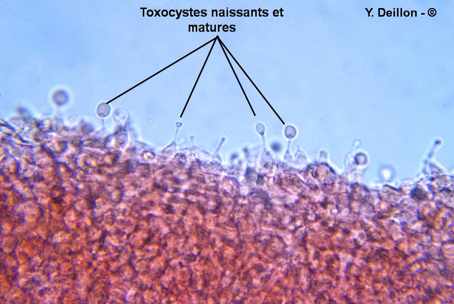 Toxocyste