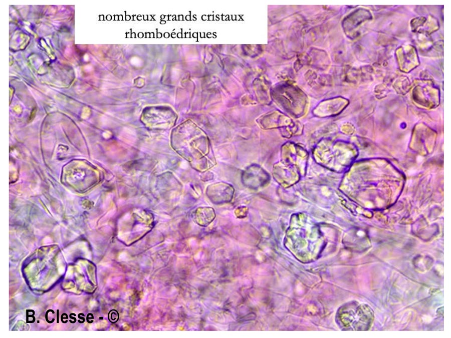 Trechispora hymenocystis