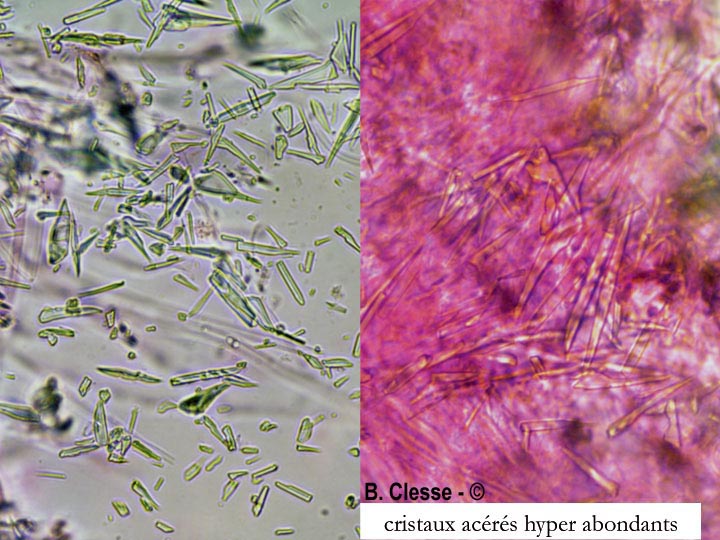Trechispora microspora