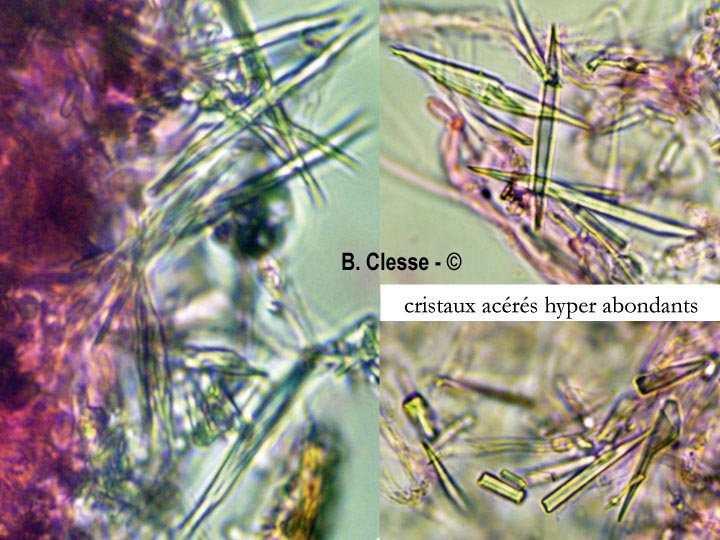 Trechispora microspora