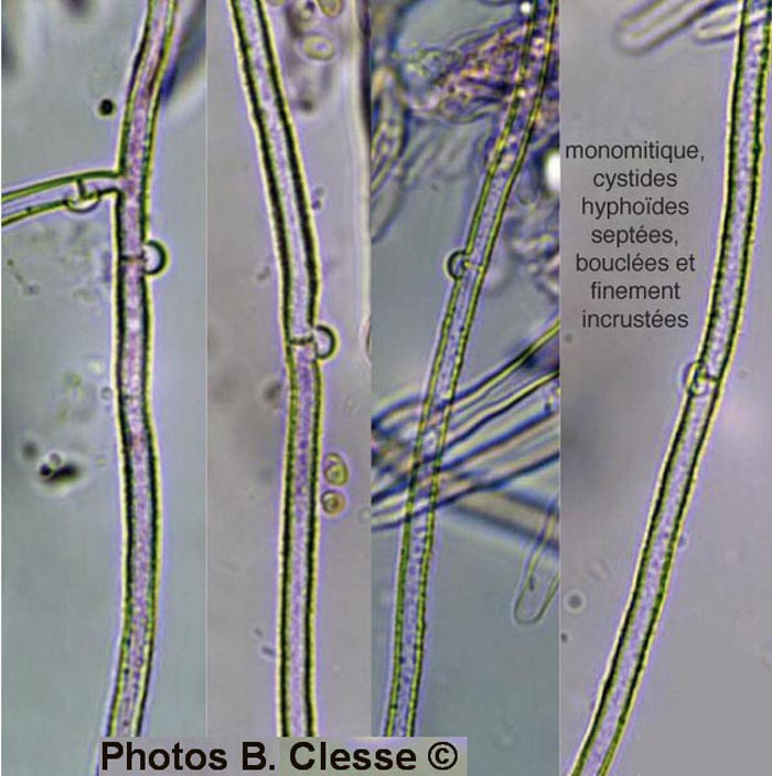 Amphinema byssoides