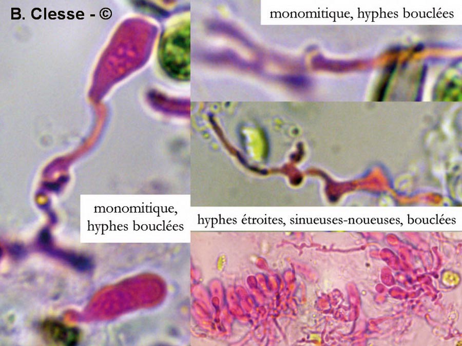 Amyloxenasma elongatisporum