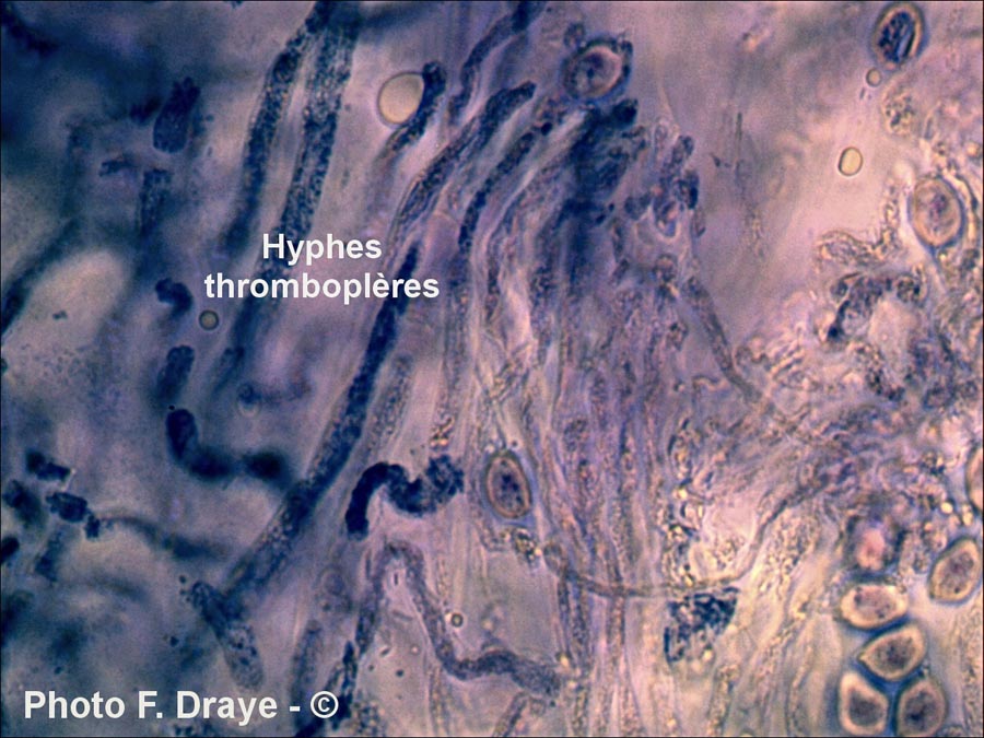 Armillaria ostoyae