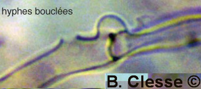 Arrhenia subglobispora