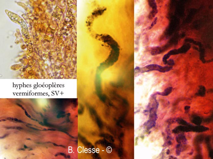 Artomyces pyxidatus