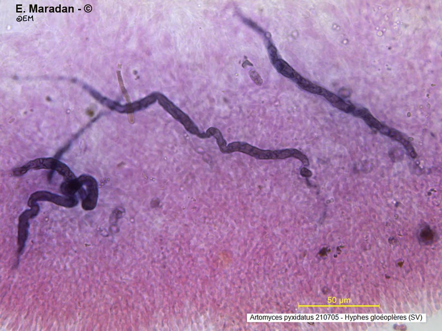 Artomyces pyxidatus