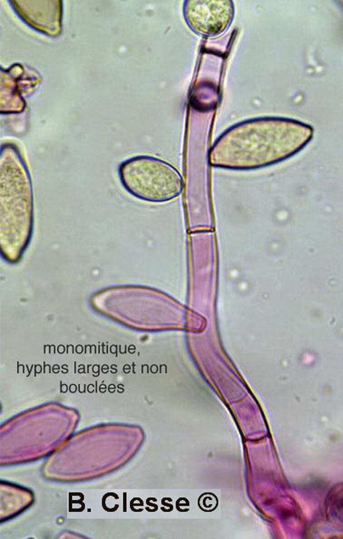 Botryobasidium aureum