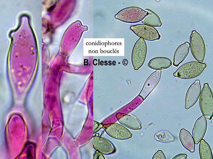 Botryobasidium aureum