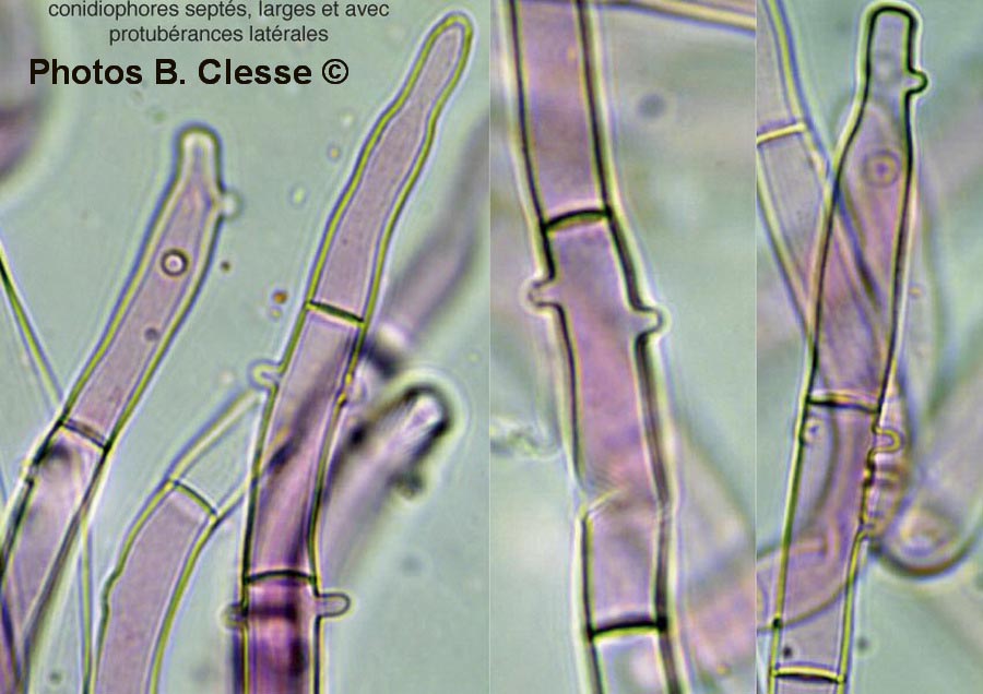 Botryobasidium conspersum