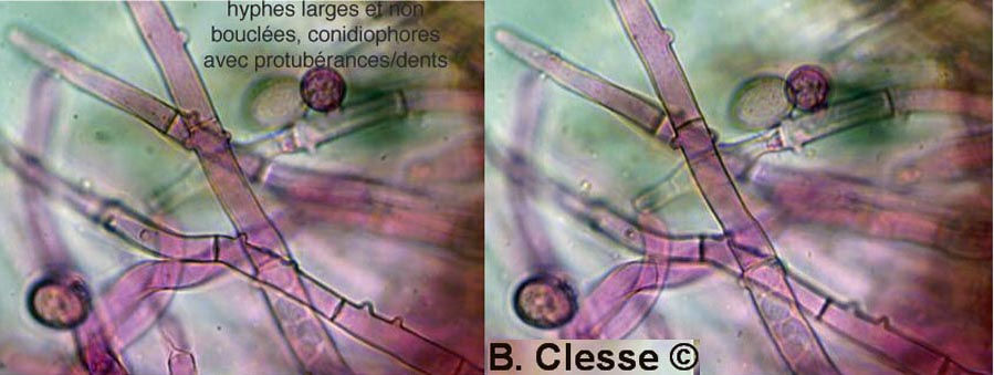 Botryobasidium conspersum