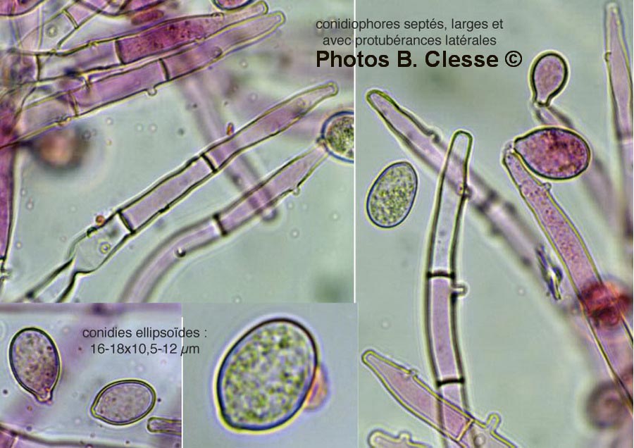 Botryobasidium conspersum