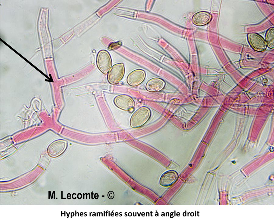 Botryobasidium conspersum