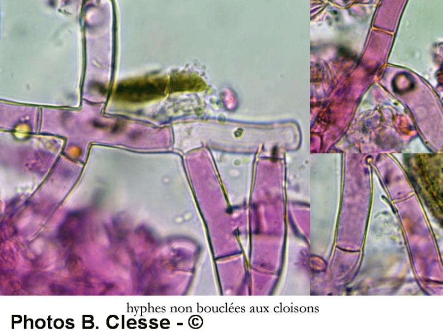 Botryobasidium ellipsosporum