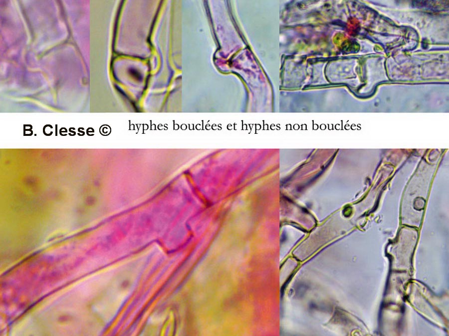 Botryobasidium intertextum