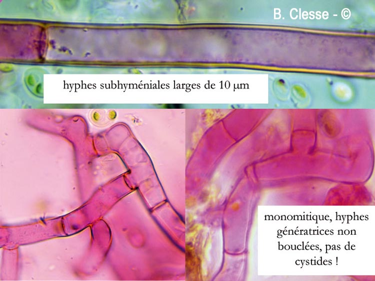 Botryobasidium laeve
