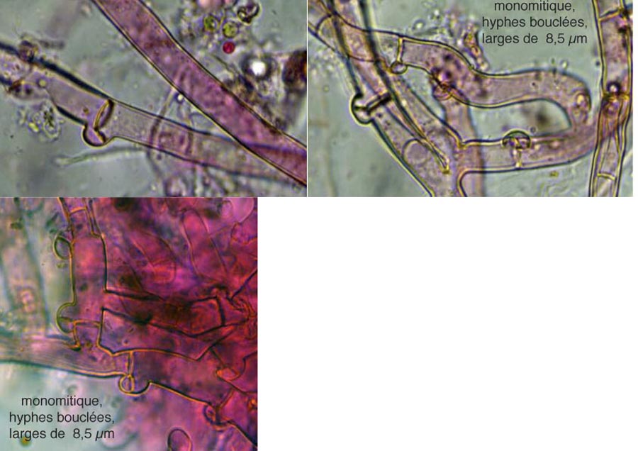 Botryobasidium subcoronatum